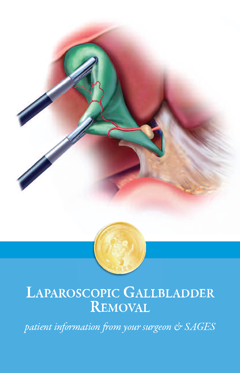 Laparoscopic Gallbladder Removal Surgery Cholecystectomy Patient