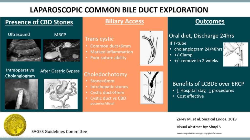 Laparoscopic Common Bile Duct Exploration Visual Graphic