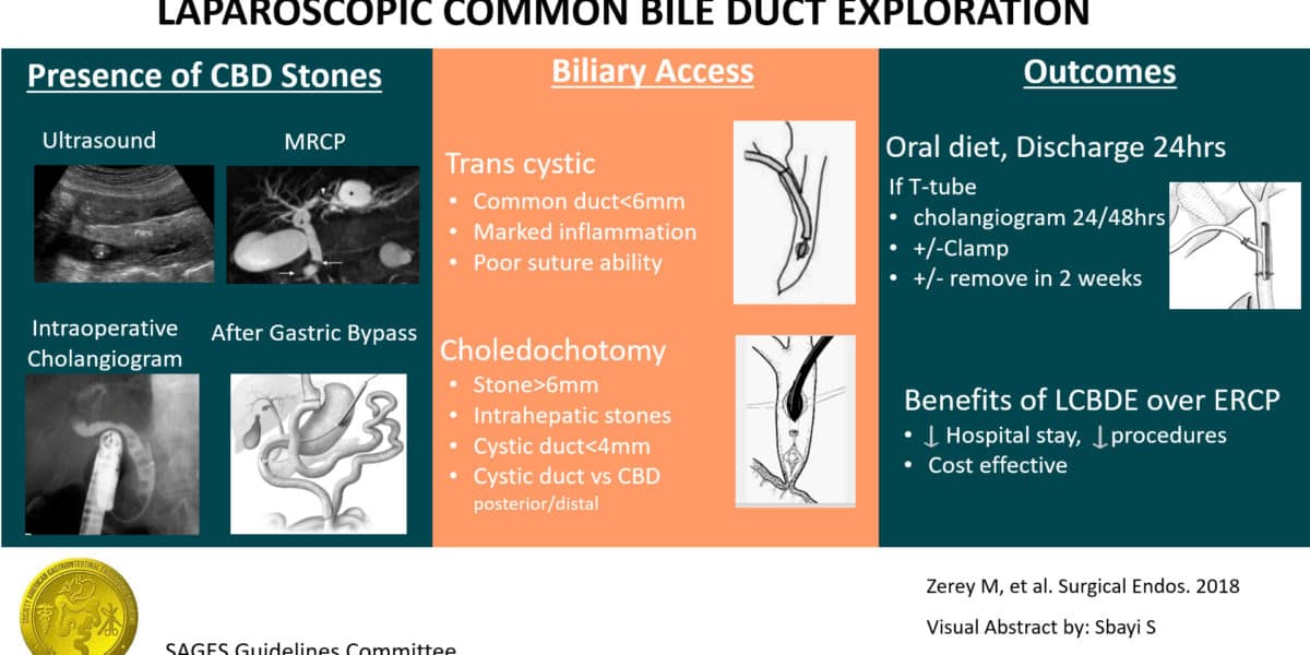 Laparoscopic Common Bile Duct Exploration Visual Graphic
