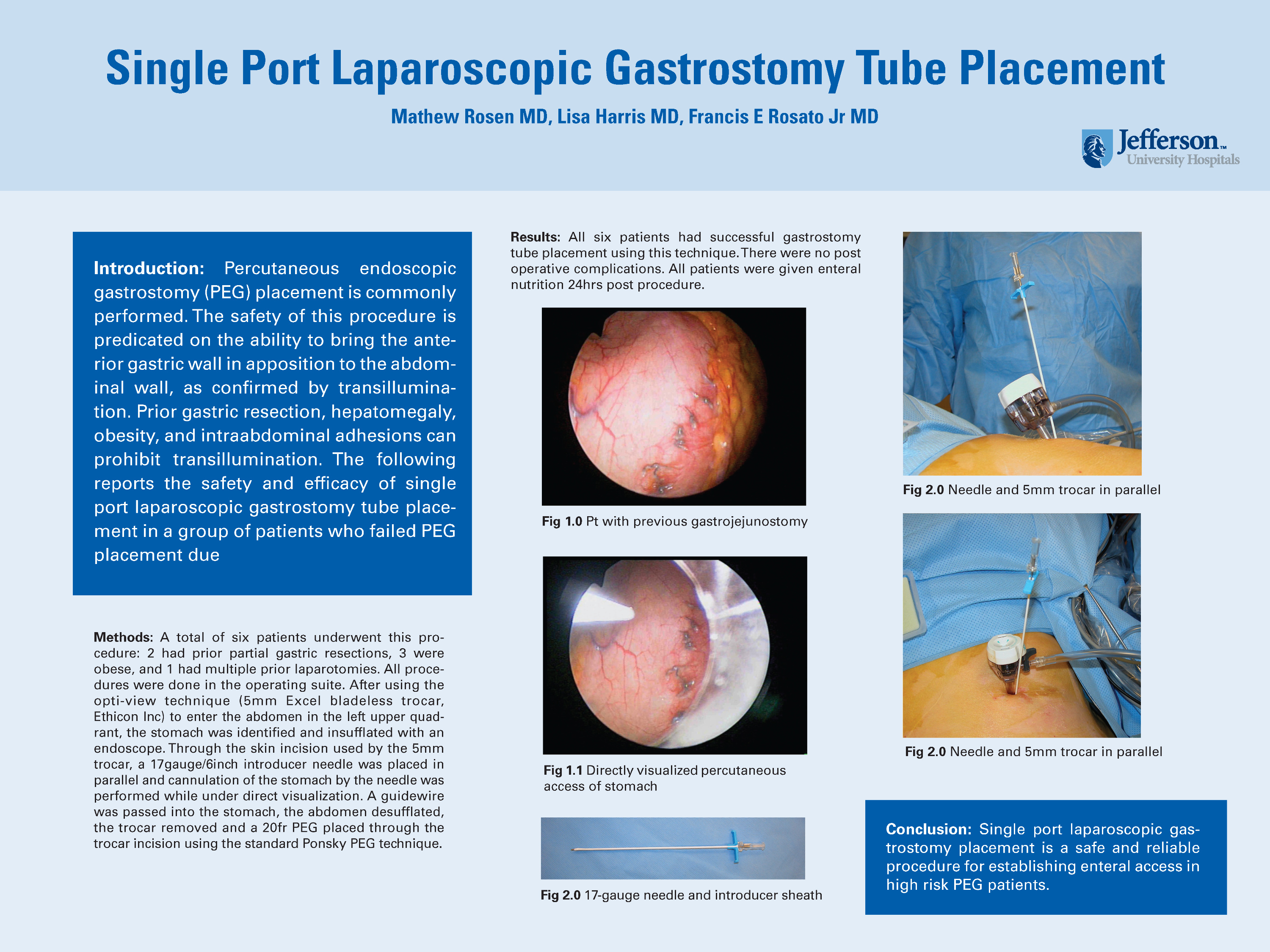 Single Port Laparoscopic Gastrostomy Tube Placement - SAGES Abstract  Archives