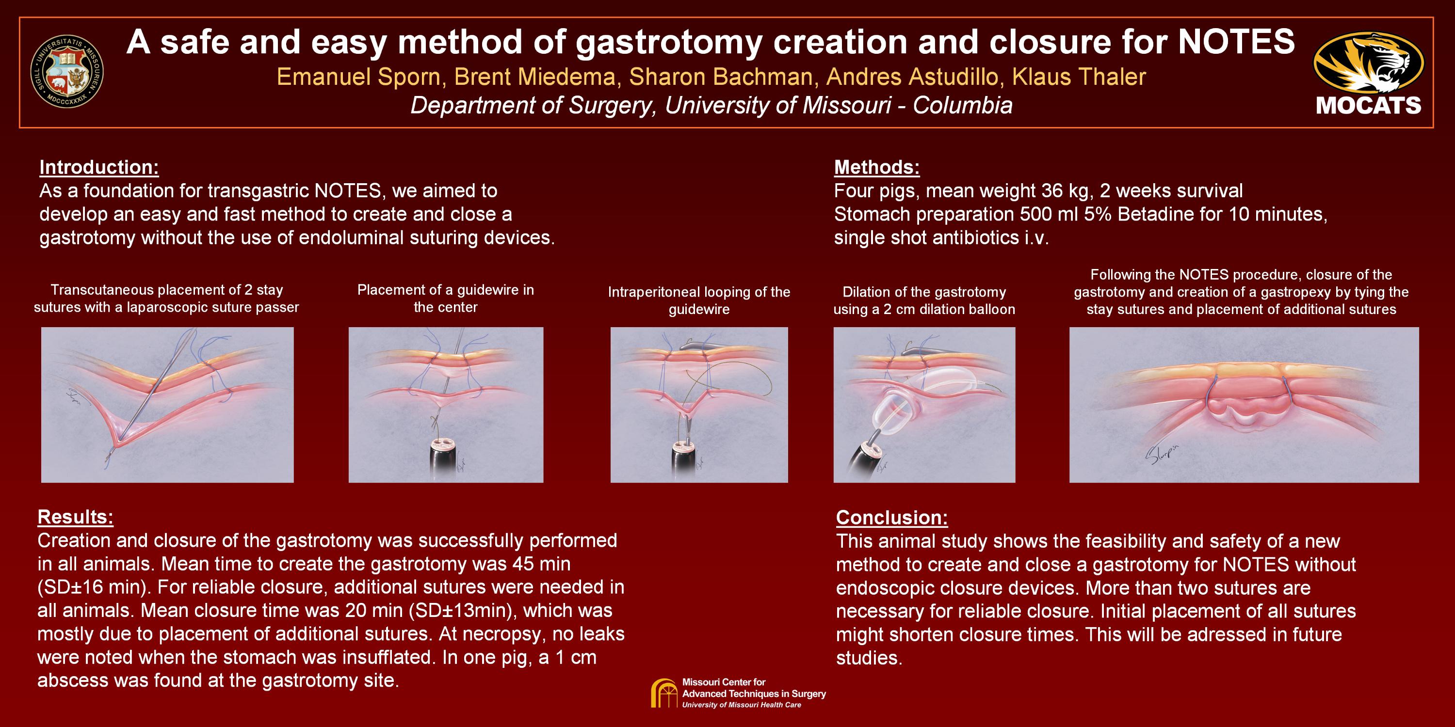 PPT) Appendectomy | Mohan R - Academia.edu